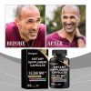 Googeer Dietary Supplement Capsules, Dietary Supplement Capsules For Body Treatment